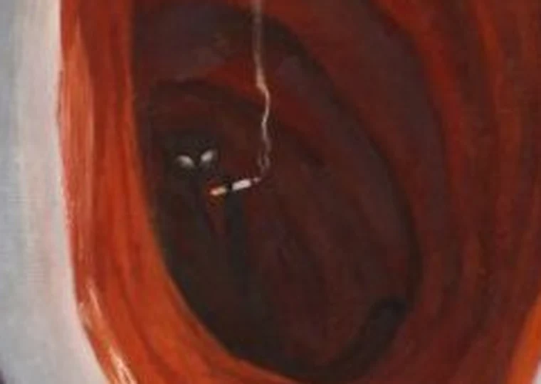 Detail